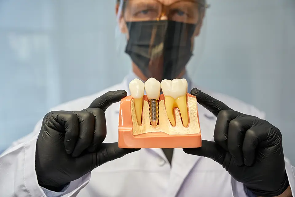 How Long Do Dental Implants Take to Heal? 1 Within 24-72 Hours after Dental Implants Surgery