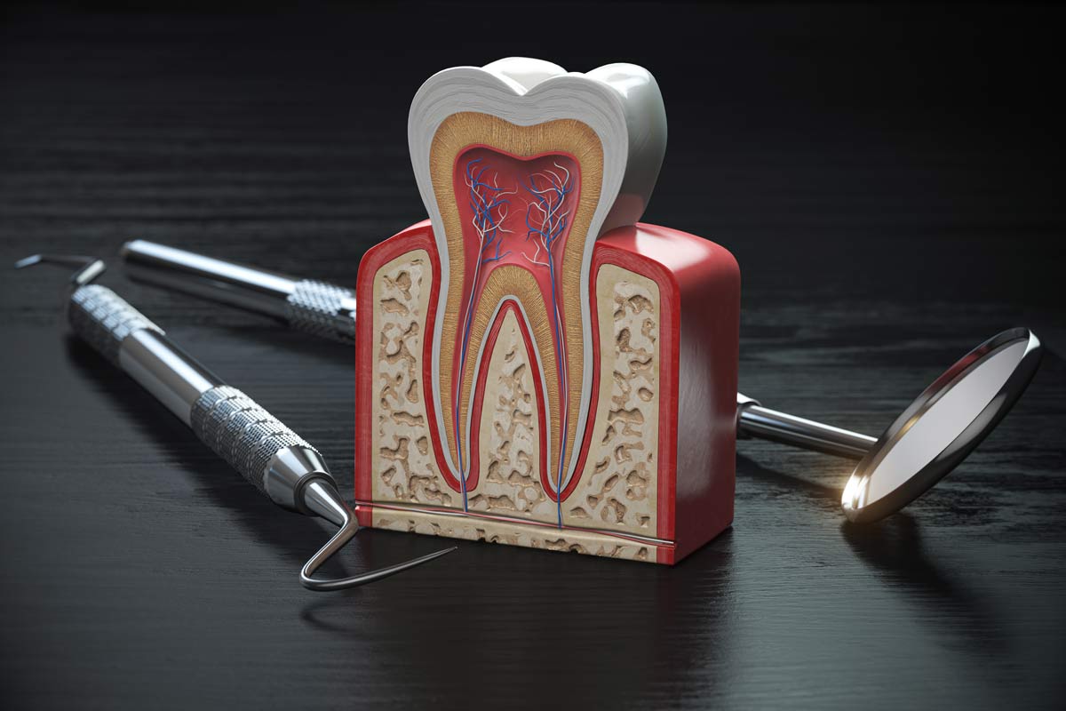 Affordable Root Canals in Toronto