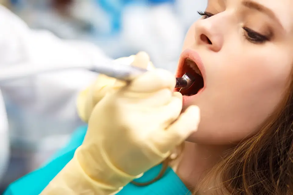 Important Truths about Root Canals 17 Important Truths about Root Canals