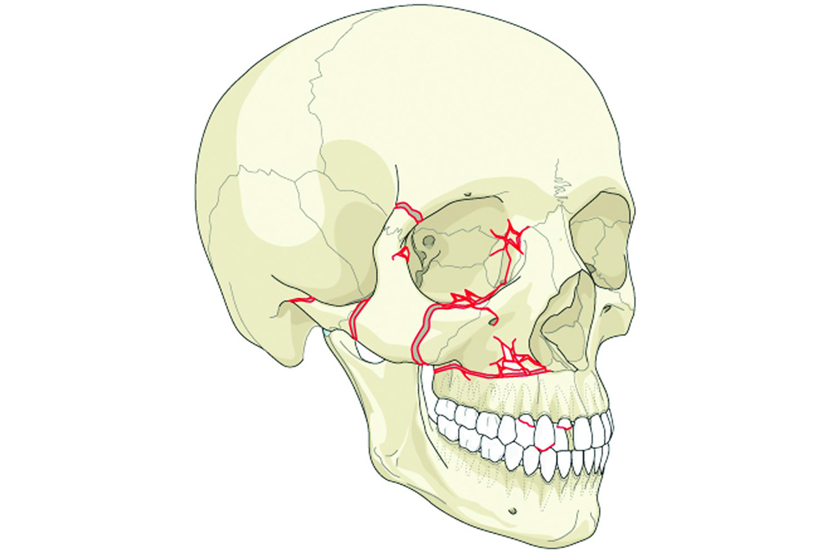 Facial Fracture Treatment in Richmond Hill, Toronto