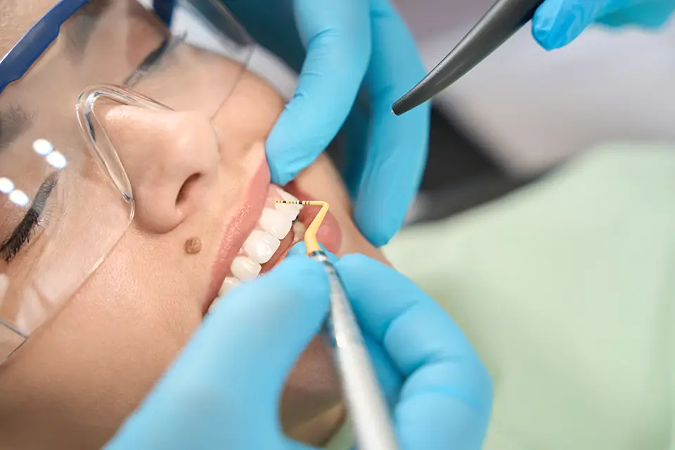 How Do Dental Bridges Work? 1 What Kinds of Dental Bridges Are Available?