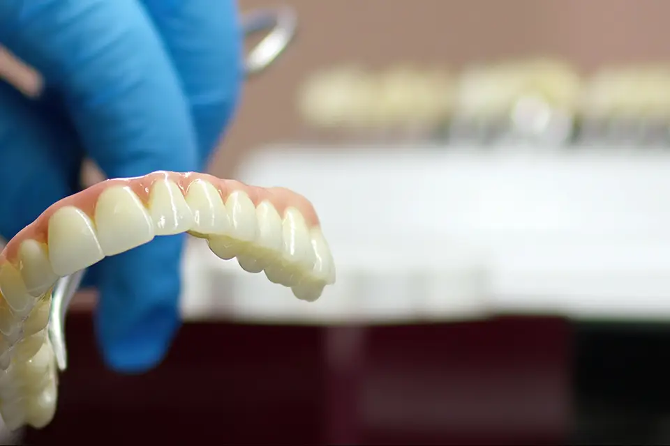 How Do Dental Bridges Work?