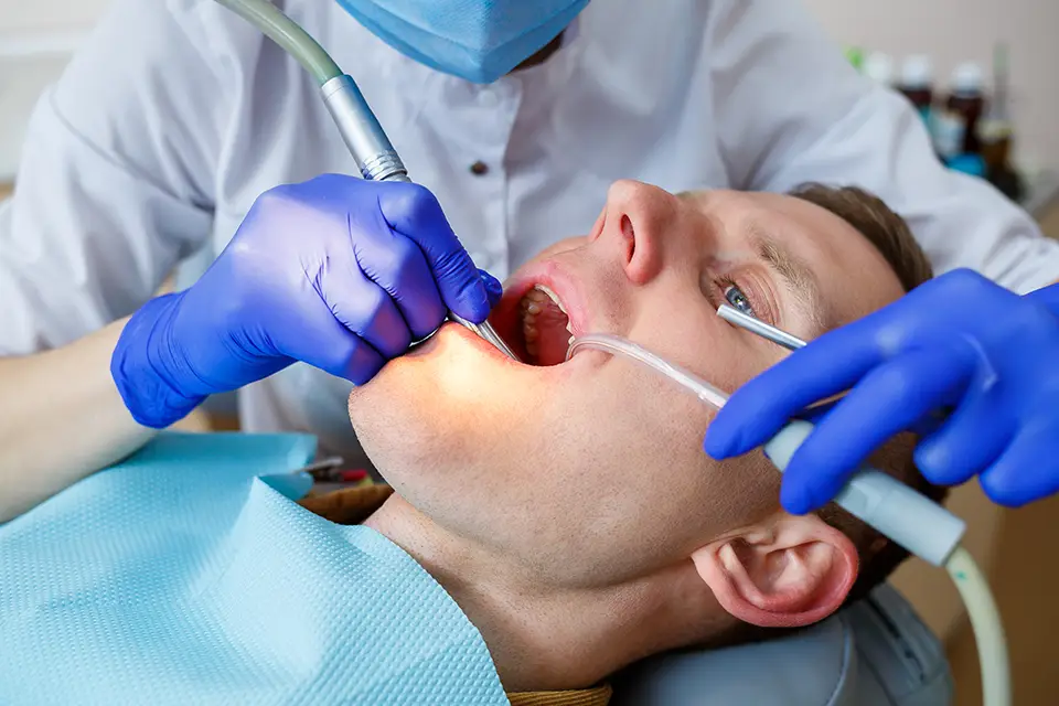 Factors Affecting the Lifespan of Root Canals