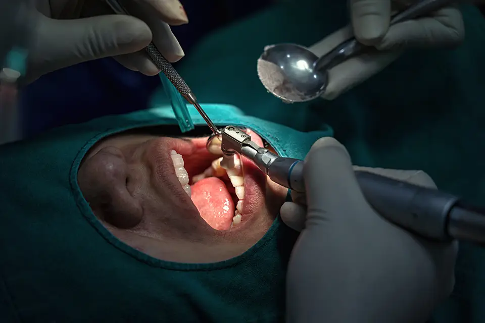 What Is a Dental Bone Graft? 1 How Long Does It Take to Recover After a Bone Graft?