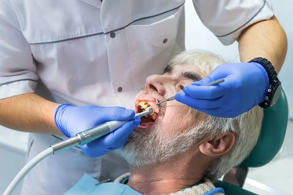 Is a Root Canal Necessary Before a Dental Crown on a Cracked Tooth? 1 When Is a Root Canal Required Before a Crown on A Cracked Tooth?
