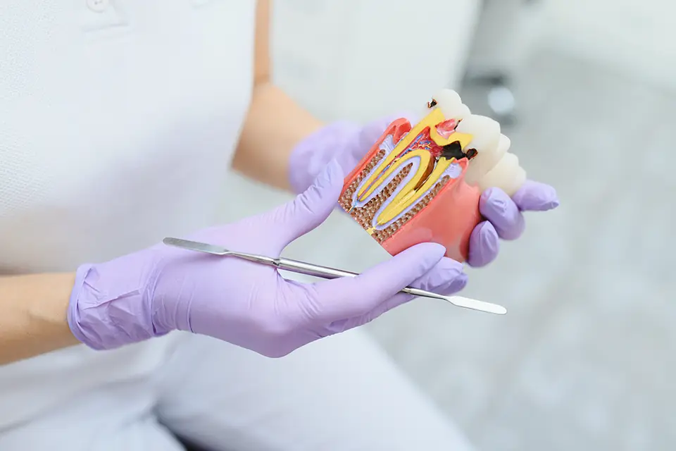 What Do Dental Implants and Gum Disease Have in Common? 1 Can Someone with Gum Disease Have an Implant?