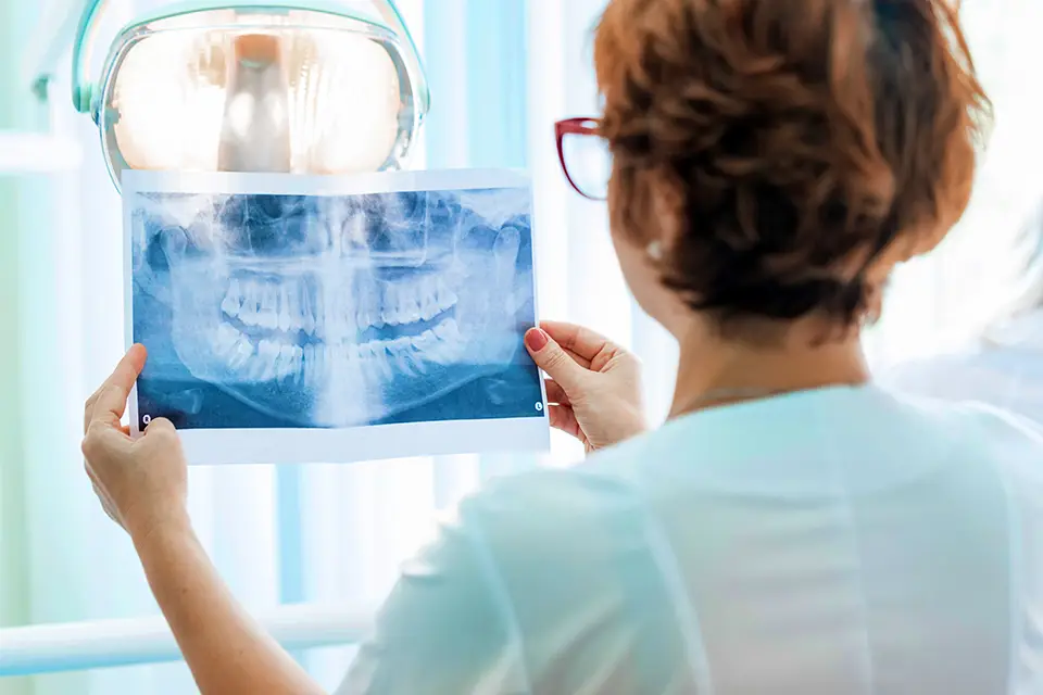 Clearer Images, Precise Treatment: Cone Beam X-Rays Revolutionize Root Canal Care 1 The Benefits of Cone Beam X-Rays for Root Canal Patients