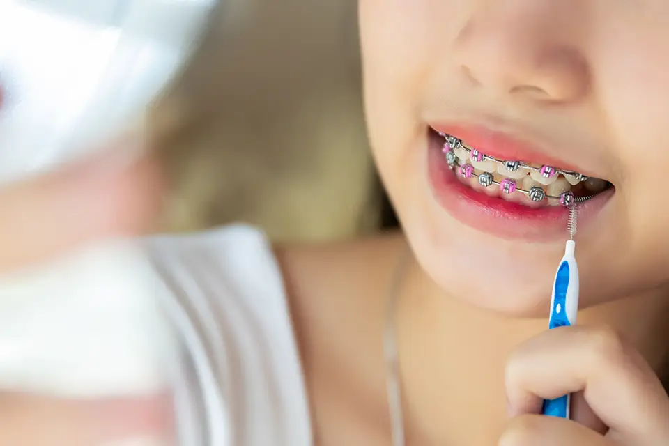 8 Tips for Good Oral Health During Orthodontic Treatments 12 8 Tips for Good Oral Health During Orthodontic Treatments