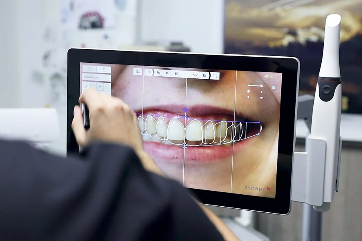 Digital Smile Design in Richmond Hill, Ontario