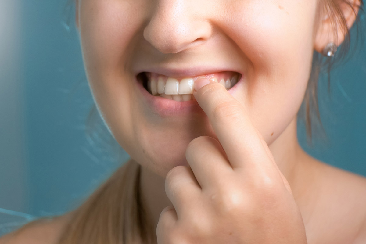 Affordable Non-Surgical Gum Disease Treatment Options in Richmond Hill, Ontario