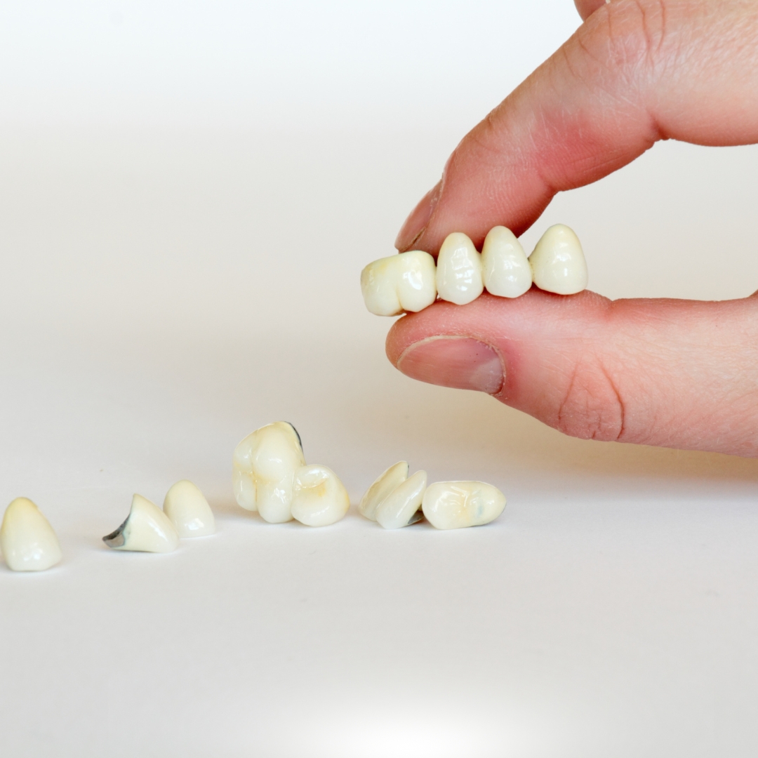 Types of Dental Crowns