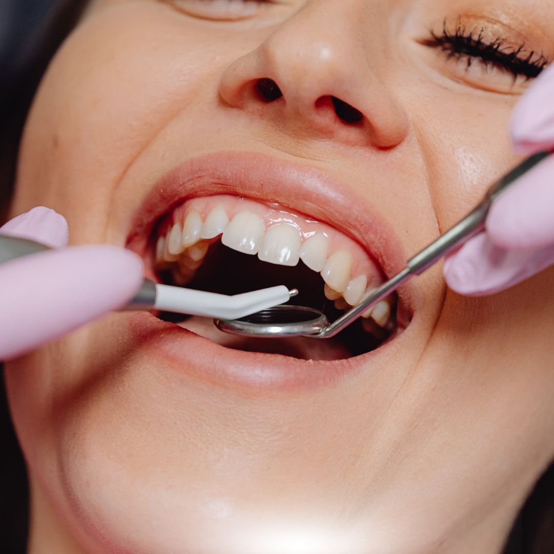 Unlocking Comfort: Is Dental Sedation Right for Me