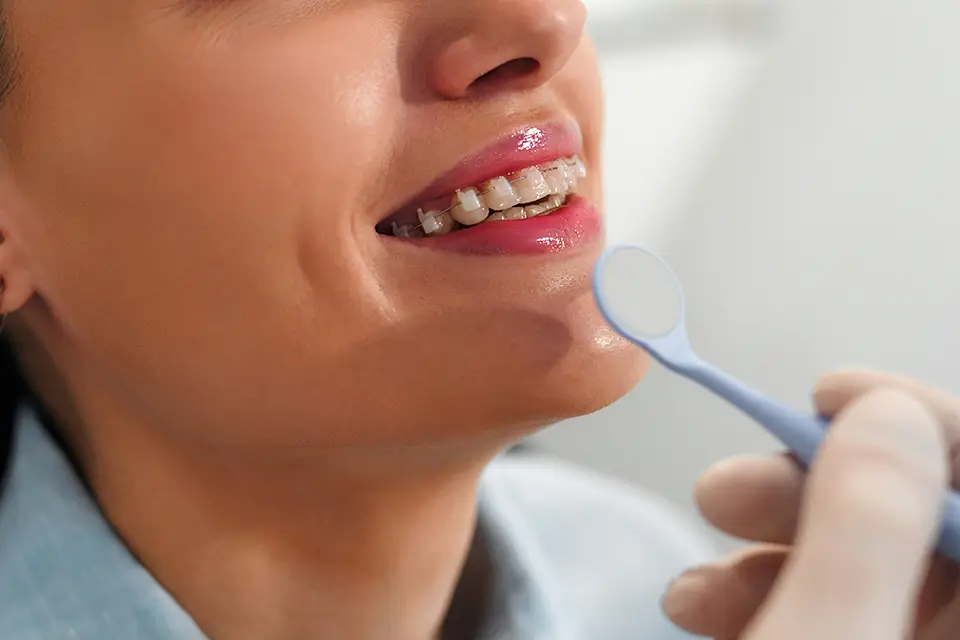 Maintaining Healthy Gums Post-Gum Disease Treatment: Vital Tips from ORIS Dental Clinics in Richmond Hill, Ontario