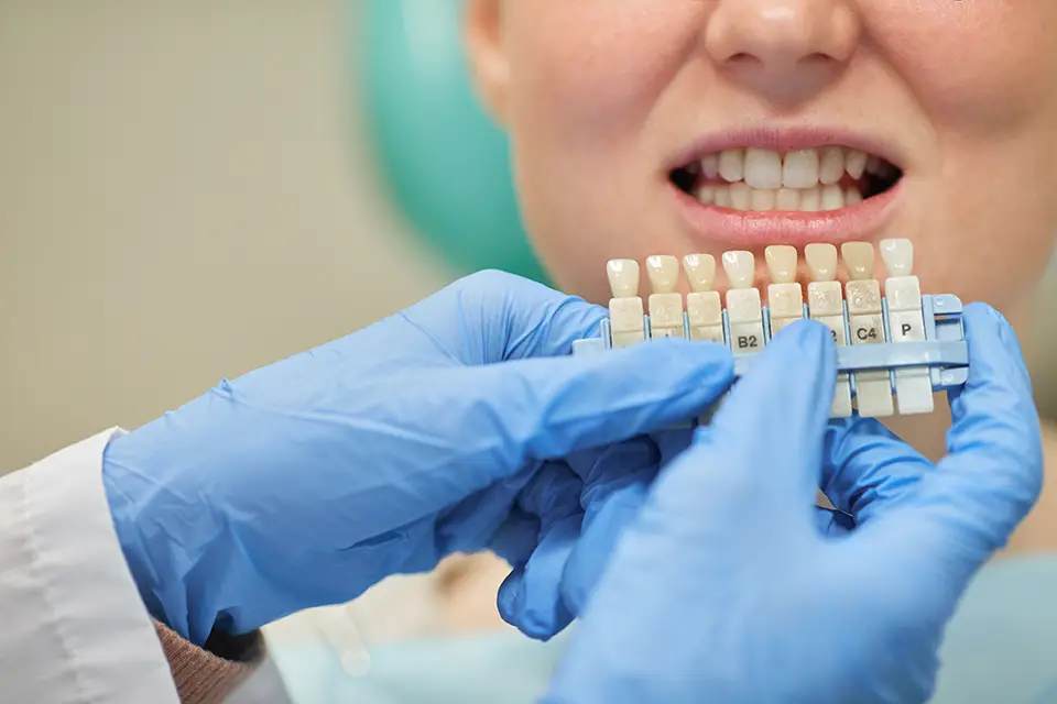 Types of Dental Crowns: Choosing the Right Material for You at ORIS Dental Clinics
