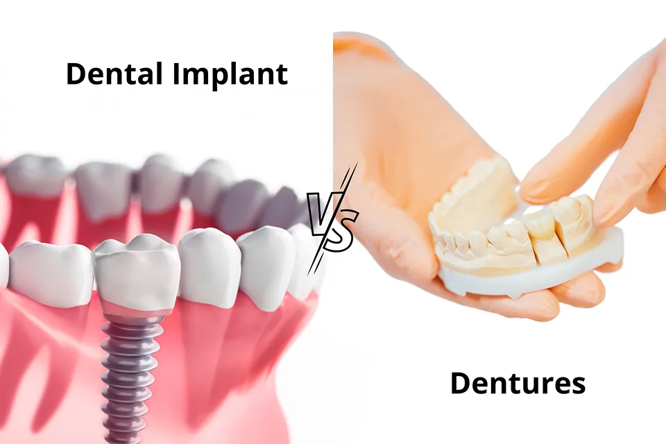 Dentures in Ontario, CA, Denture Options