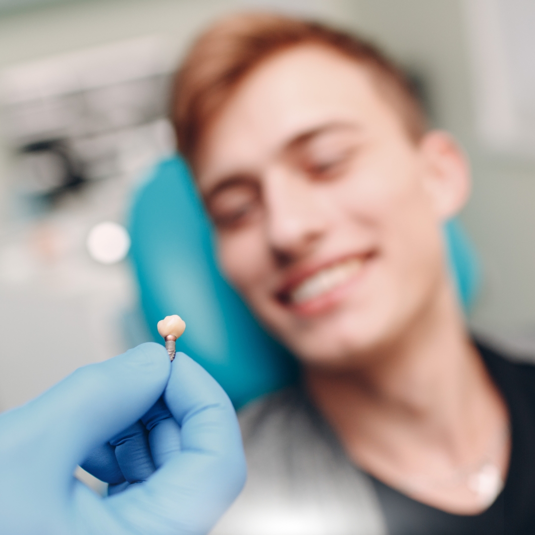 Dental Implants for Front Teeth