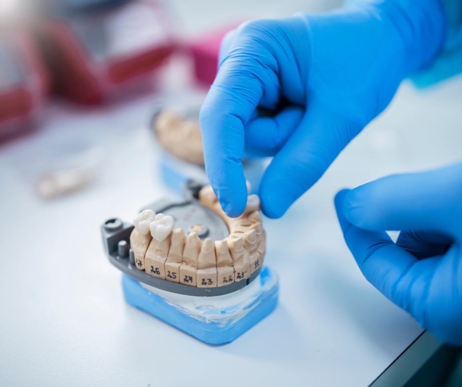 Dental Bridges for Seniors