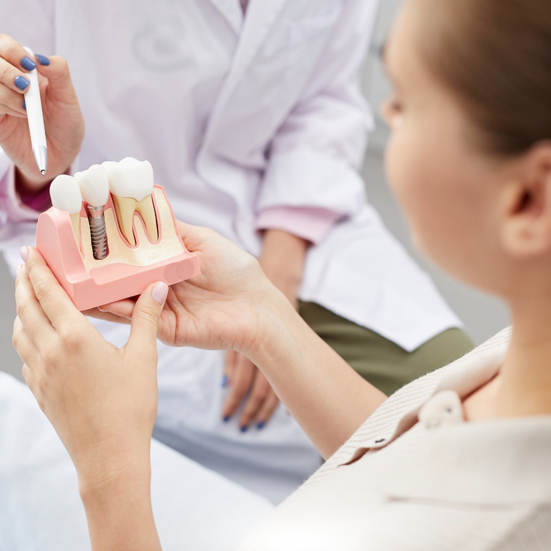 Dental Implants FAQs