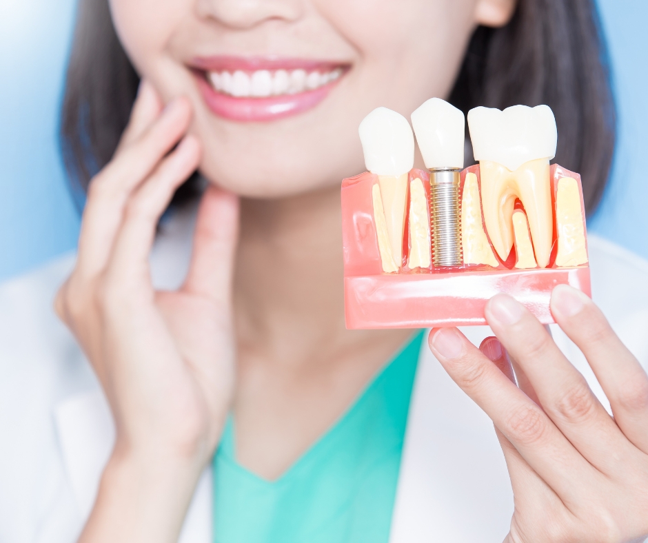 Dental Implant Companies in the World