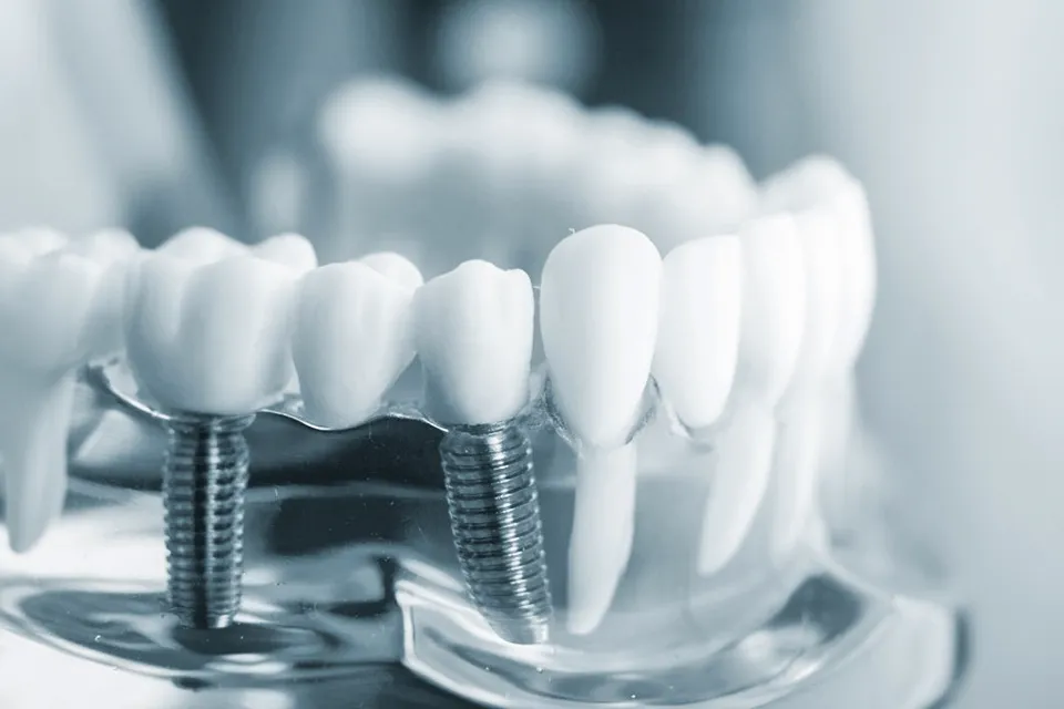 How Google Uses dentistry in Dwarka To Grow Bigger