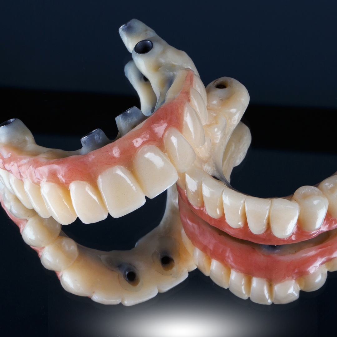 The Cost of Full Mouth Dental