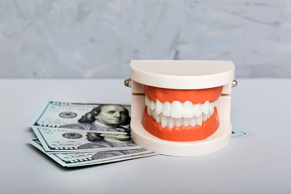 Gum Graft Cost for 4 Teeth: A Comprehensive Guide