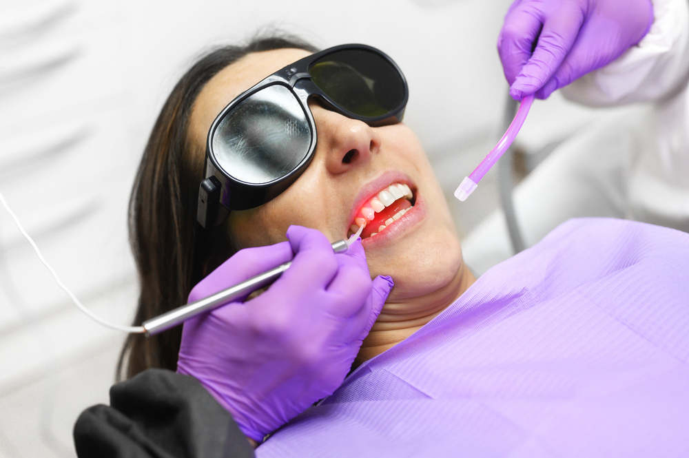 LANAP Laser Gum Surgery