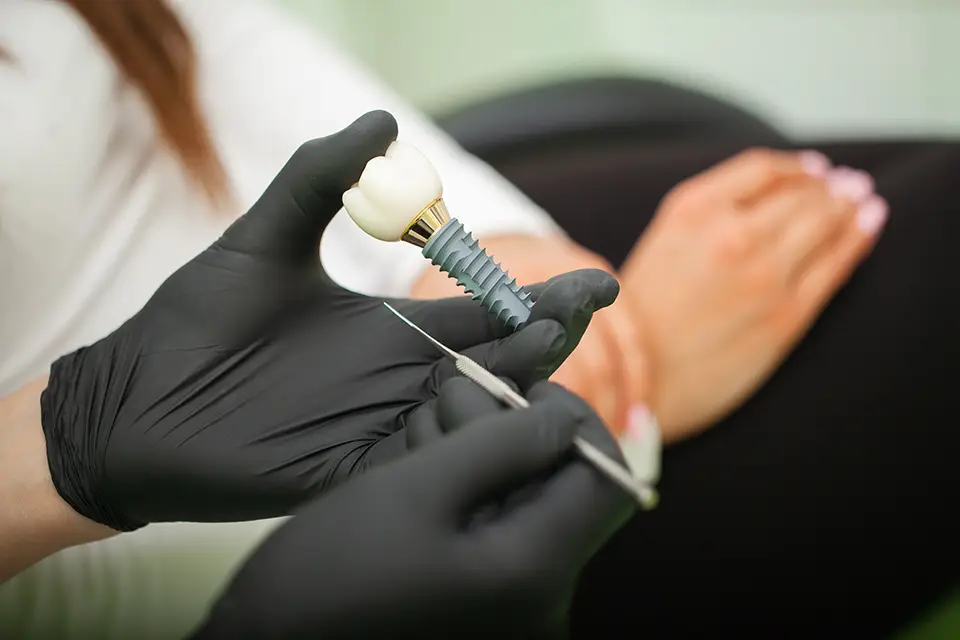 Endosteal Dental Implants: A Patient-First Guide