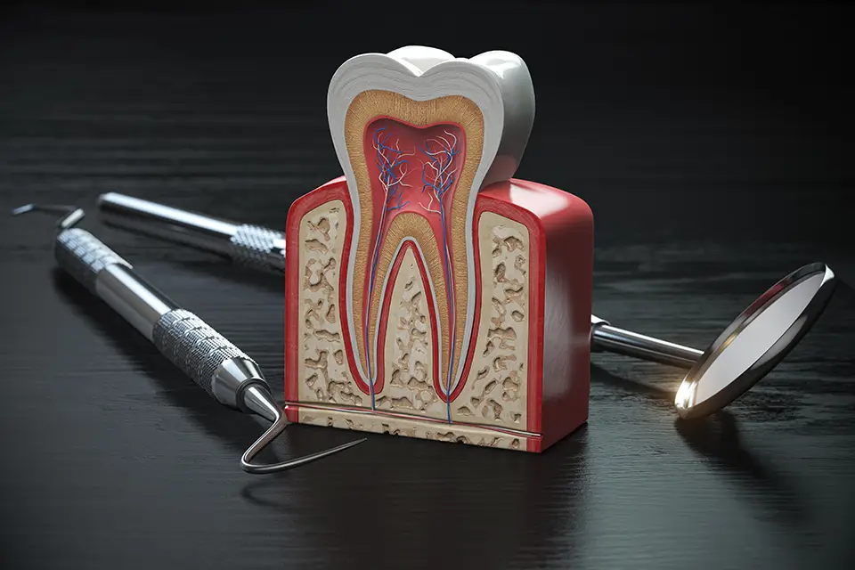 Step-by-Step Guide to the Root Canal Therapy Procedure