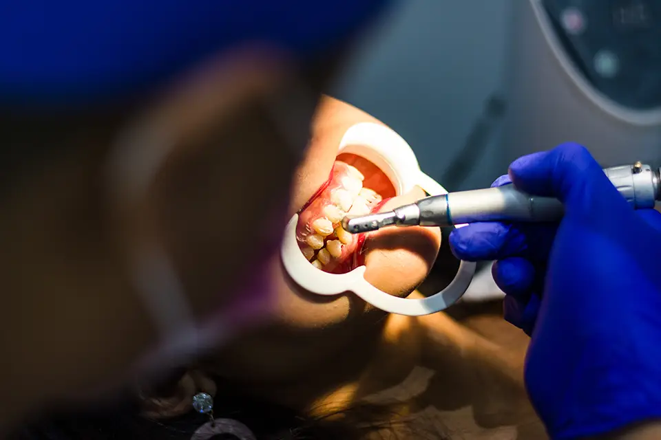 Top Periodontal Treatment Options for Healthy Gums 2 Periodontal Treatment Options: Maintenance, Timelines, and Costs