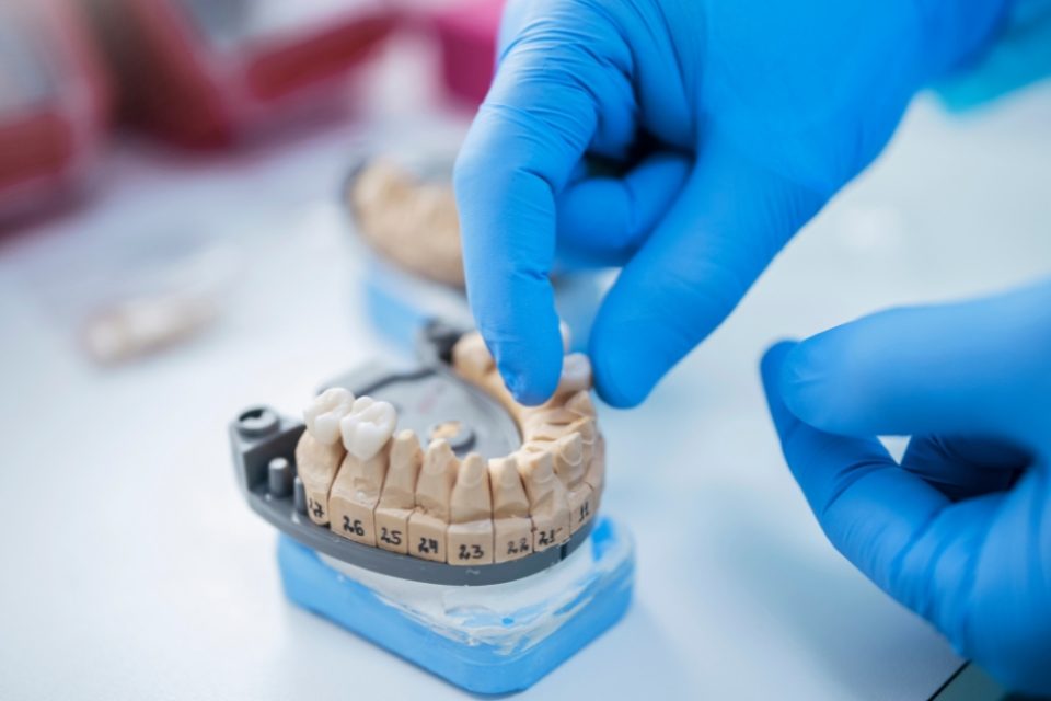 Dental Bridges for Seniors Dental Bridges for Seniors