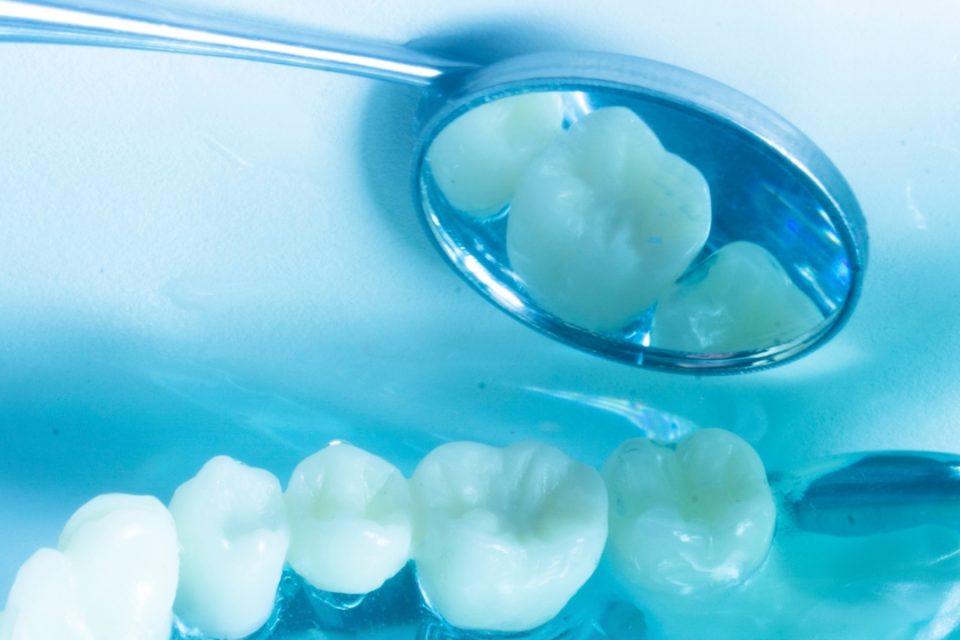 Dental Implants and Sinus Lifts Addressing Bone Volume Issues at ORIS Dental Clinics Dental Implants and Sinus Lifts Addressing Bone Volume Issues at ORIS Dental Clinics