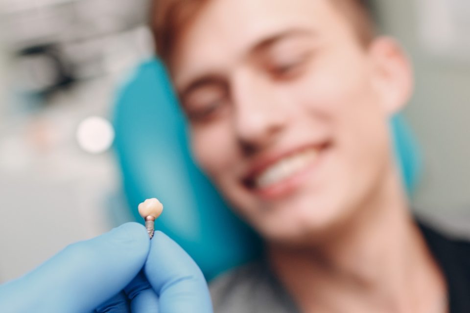 Dental Implants for Front Teeth Dental Implants for Front Teeth