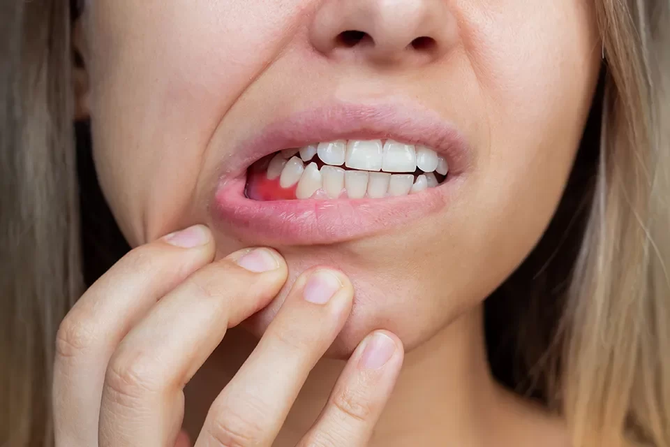 Periodontics