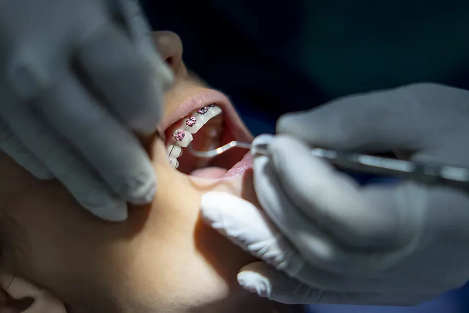 Orthodontics