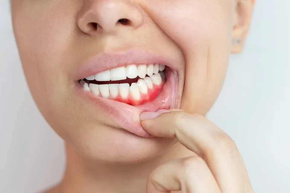 Periodontics