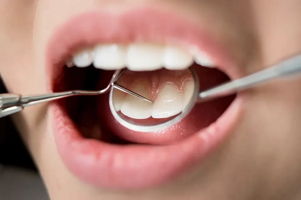 Restorative Dentistry