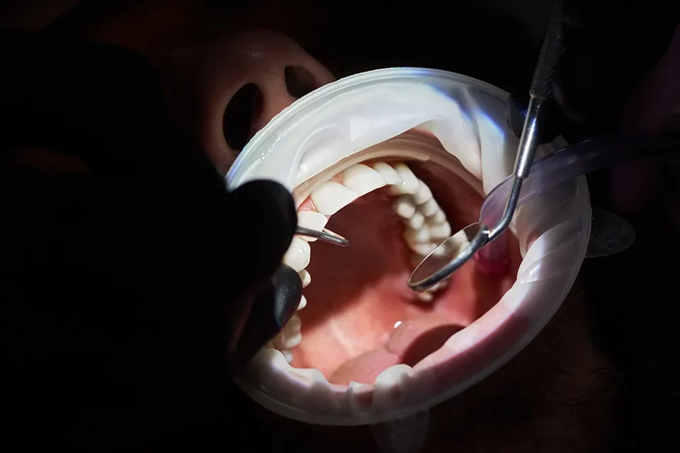 Restorative Dentistry