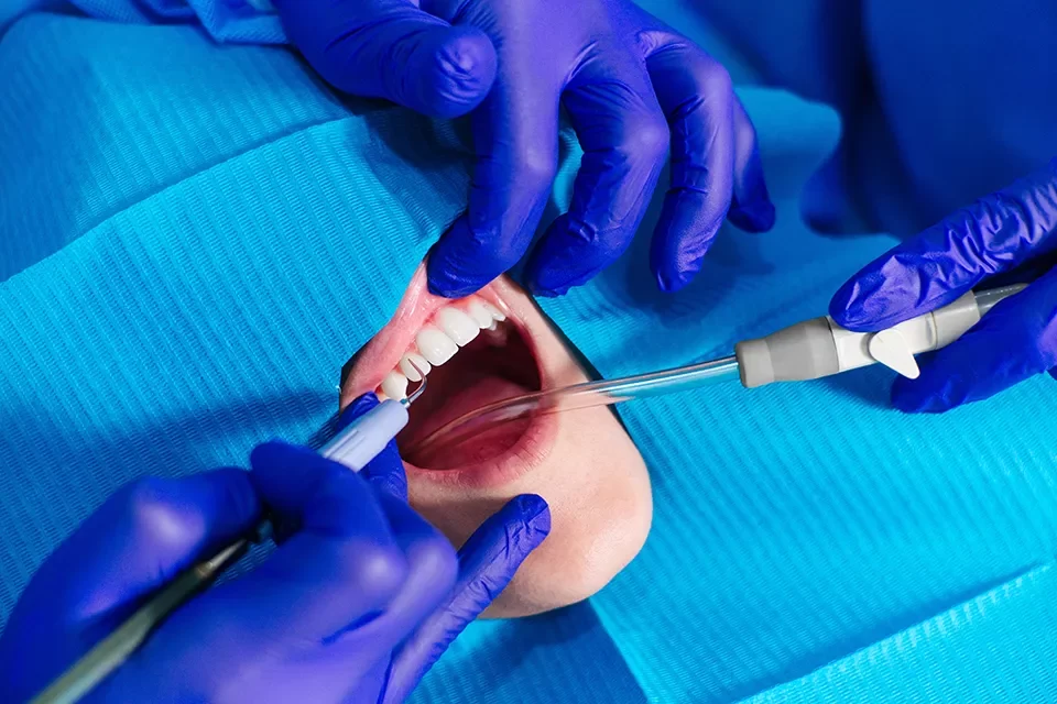 Oral and Maxillofacial surgery
