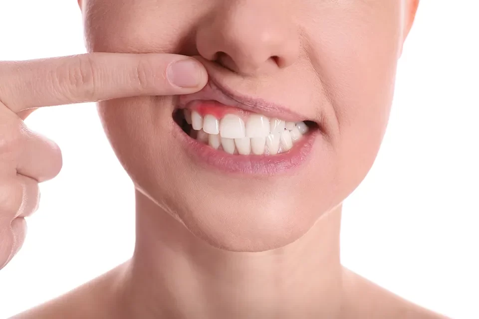 Periodontics