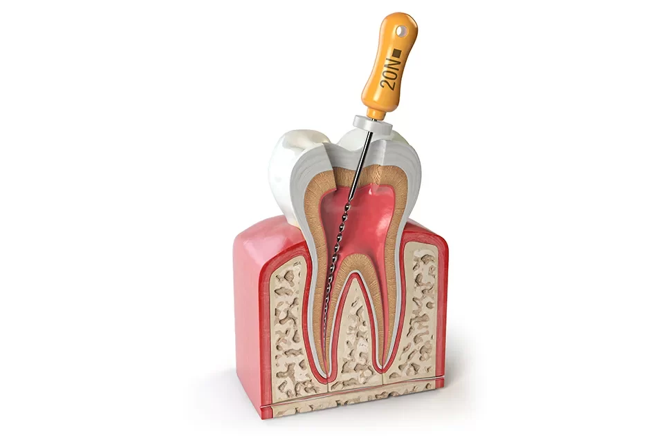 Endodontics
