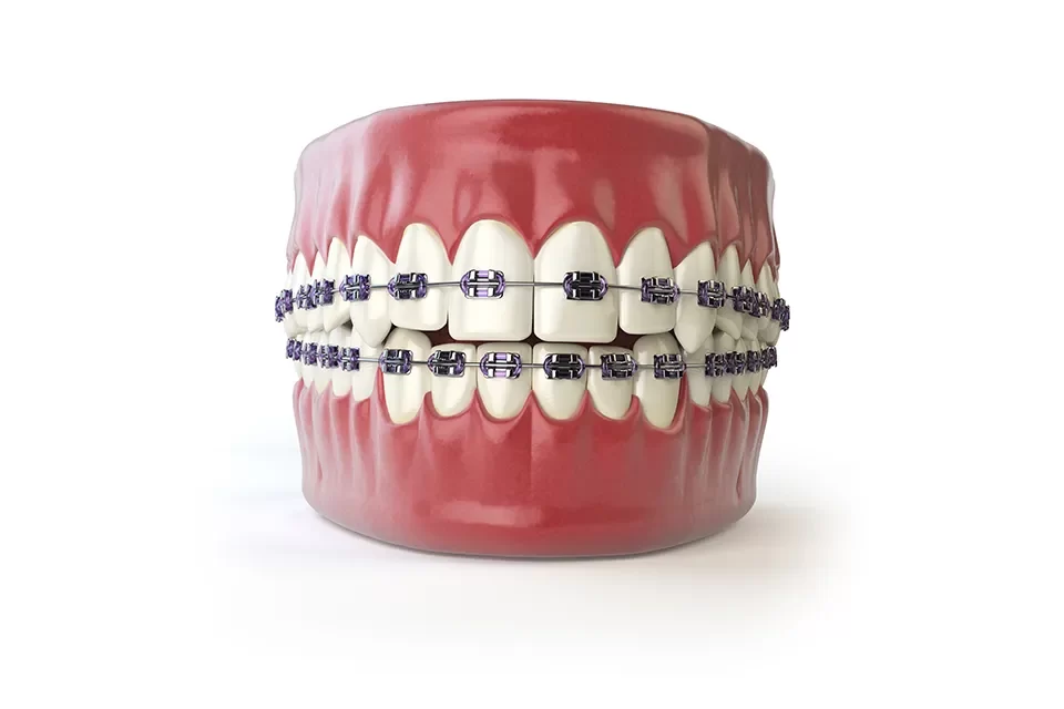 Orthodontics
