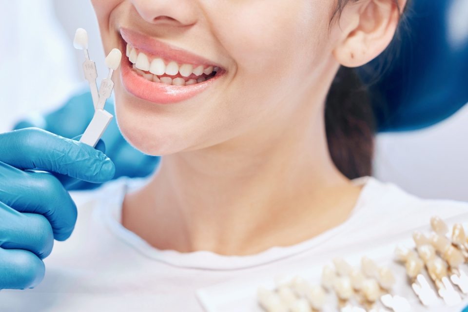 Untitled design (11) Dental Crown Alternatives