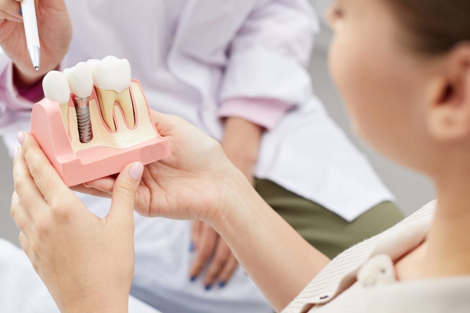 Untitled design (14) Dental Implants FAQs