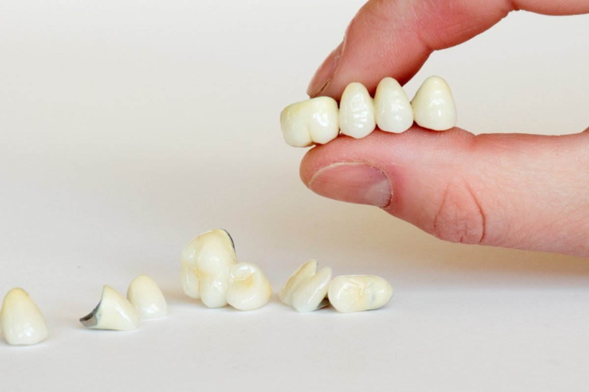 Untitled design (19) Types of Dental Crowns