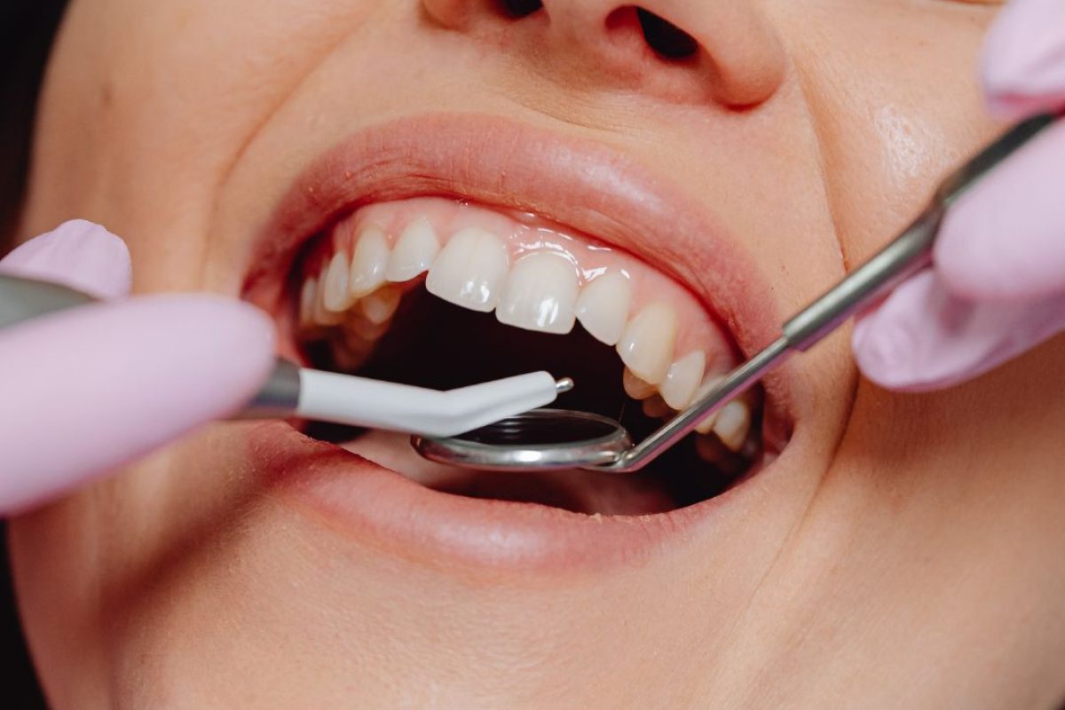Untitled design (21) Unlocking Comfort: Is Dental Sedation Right for Me