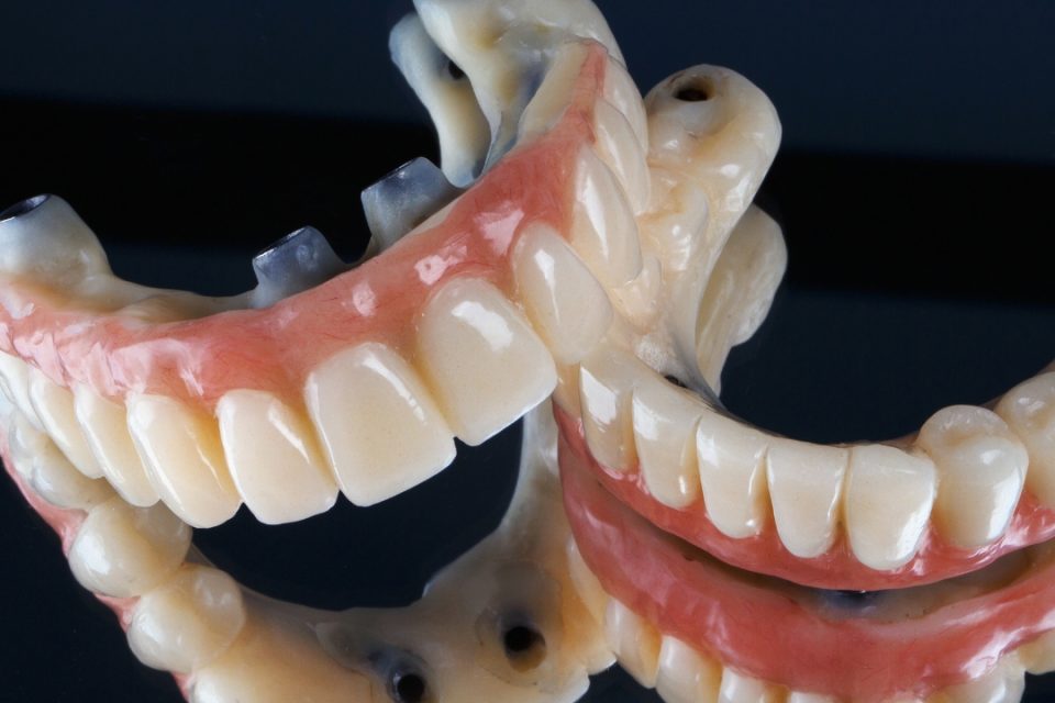 Untitled design (8) The Cost of Full Mouth Dental