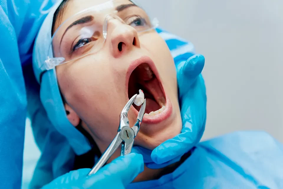 Wisdom Tooth Removal
