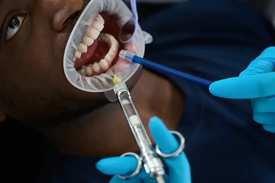 Why Might You Need Periodontal Disease Treatment?
