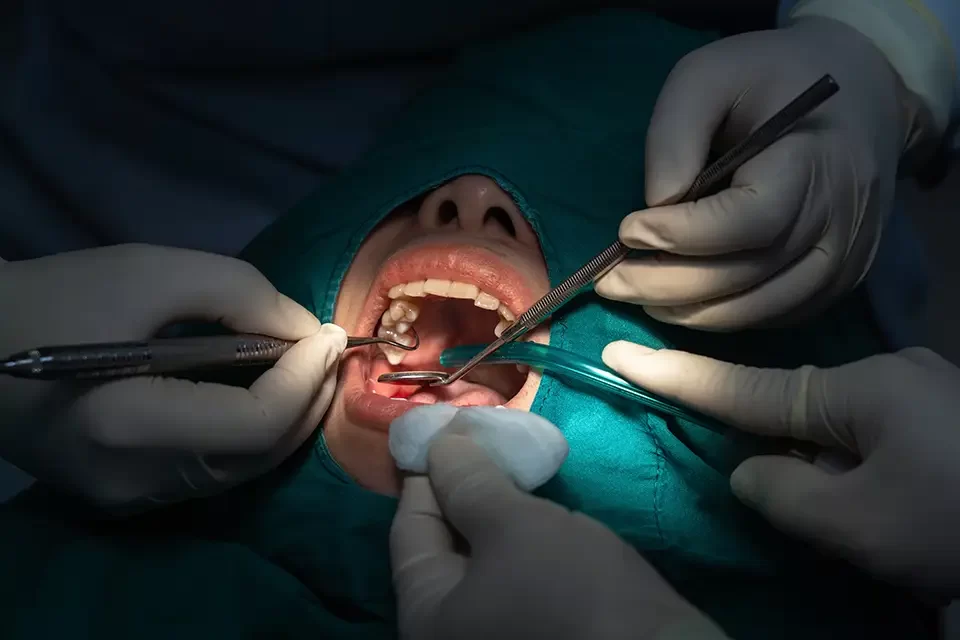 What Is Dental Surgery?